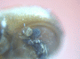 Diuncus justus junior synonym Xyleborus apiculatus antenna