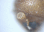 Diuncus adossuarius antenna